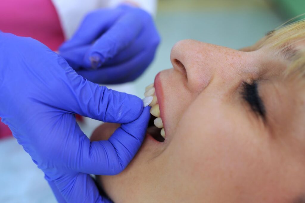 A woman getting veneers.